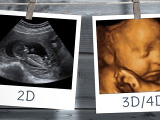 3d-4d-scan